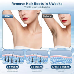 Laser Hair Removal IPL Hair Removal Device for Women & Men,Safe At-Home 5℃ Ice-Cooling,Painless & Long-Lasting Results,86% Less Hair In 3 Weeks for Full Body & Face,Bikini Line,Manual & Auto Mode
