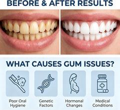 4Pcs Value Pack Gum Care Gel, Daily Oral Care Formula for Gum Comfort & Fresh Breath, Gentle Enamel-Friendly Dental Gel with Precision Applicator for Home & Travel Use