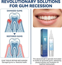 4Pcs Value Pack Gum Care Gel, Daily Oral Care Formula for Gum Comfort & Fresh Breath, Gentle Enamel-Friendly Dental Gel with Precision Applicator for Home & Travel Use